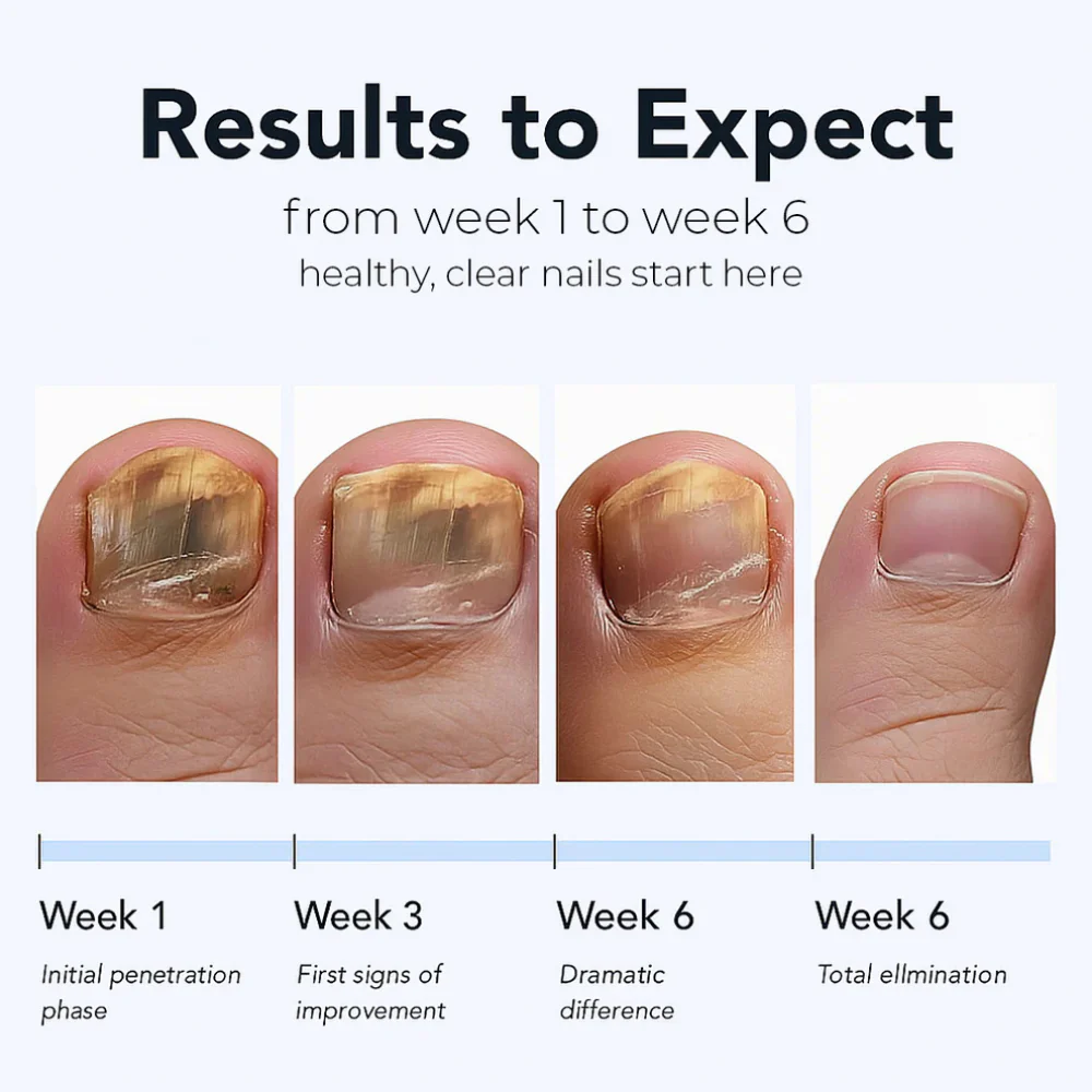 Maanufo Fungal Nail Renewal Patches