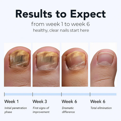 Maanufo Fungal Nail Renewal Patches
